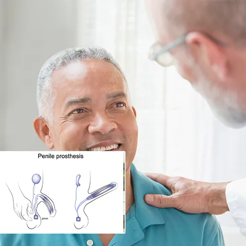 Welcome to the Trusted World of  Peoria Day Surgery Center

Penile Implant Solutions